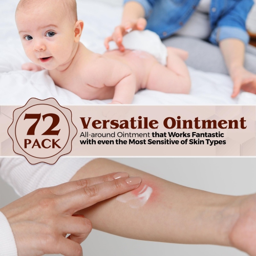 MEDca Vitamin A & D Diaper Rash Ointment- Protectant Cream For Sensitive Baby Skin - Lanolin & Petrolatum Formula, Dry-Cracked Hands/Feet/Face Skin,