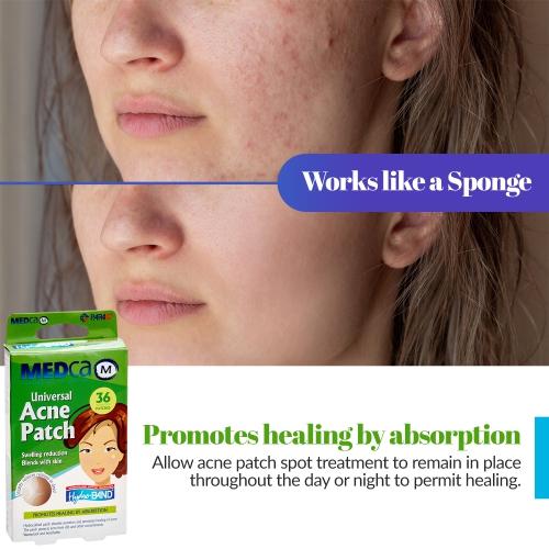 Acne Care Pimple Patch Absorbing Cover - Hydrocolloid Bandages Two Universal Sizes, Acne Spot Treatment for Face & Skin Spot Patch That Conceals