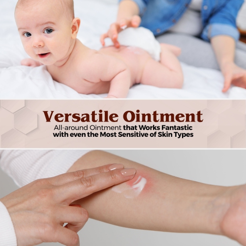Medca Vitamin a & D Diaper Rash Ointment- Protectant Cream for Sensitive Baby Skin - Lanolin & Petrolatum Formula, Dry-Cracked Hands/feet/face Skin,