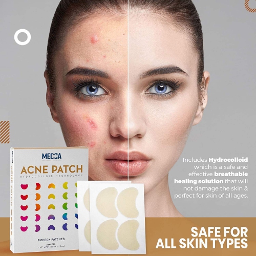 Medca Acne Care Pimple Patch - 8 - Cheek Size Acne Spot Treatment Hydrocolloid Bandage Absorbing Cover for Face Skin Acne Spot Patch Conceals,