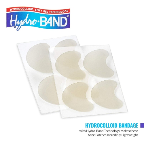 Medca Acne Care Pimple Patch - 8 - Cheek Size Acne Spot Treatment Hydrocolloid Bandage Absorbing Cover for Face Skin Acne Spot Patch Conceals,