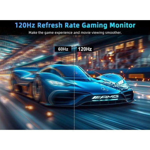 UPERFECT 18.5" 1080P Portable Monitor 120Hz Portable Gaming Monitor Switch Display w/VESA and Smart Cover For Xbox One