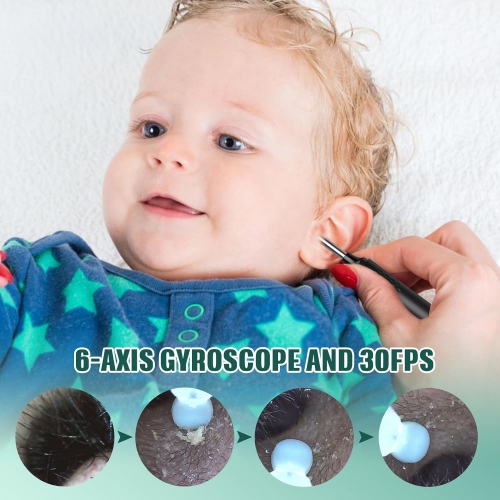 LMECHN – Nettoyant d’oreille pour appareil photo, caméra d’oreille visible sans fil à 360° avec Wi-Fi, nettoyage des oreilles