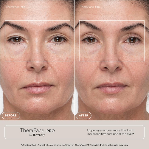 TheraFace PRO Microcurrent Facial Device - 8-in-1 Compact Face Massager, Facial Kit & Face Sculpting Tool with LED Light Therapy