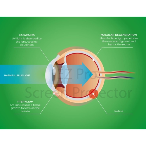 Premium Anti Blue Light and Anti Glare Screen Protector for 14 inches Laptop with Aspect Ratio 16:9. Easy