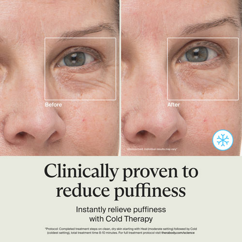 Bâton lissant Theraface de Therabody - Blanc