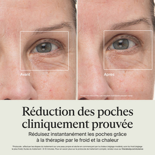 Bâton lissant Theraface de Therabody - Blanc