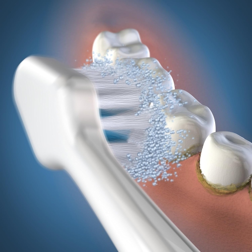 Têtes de brosse de rechange Triple Sonic Waterpik™ - Paquet de 3