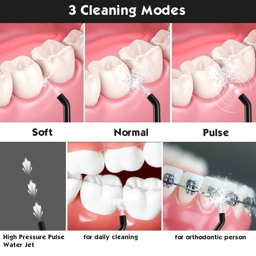 MOSPRO Electric Water Flosser, Dental Oral Irrigator with 4 Jet Tips, 3 Modes, 300ML Water Tank, USB Rechargeable for Teeth, Gums, Braces, Dental Care