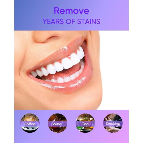 MySmile 4Pcs 35% Non-Sensitive Teeth Whitening Gel Refill Pack Kit- Effective Painless Carbamide Peroxide Enamel Safety Mint Flavor Teeth Whitener