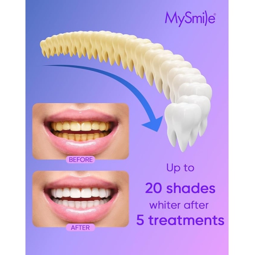 MySmile 4Pcs 35% Non-Sensitive Teeth Whitening Gel Refill Pack Kit- Effective Painless Carbamide Peroxide Enamel Safety Mint Flavor Teeth Whitener