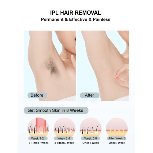 IPL Hair Removal,Laser Hair Removal At-Home for Women Men,Hair Removal Device for Facial Legs Arms Bikini Line-White