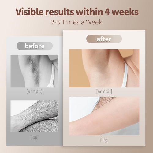 IPL Hair Removal Device Freezing Point Laser Hair Shaver Photon Hair Epilator for Facial Legs Arms Bikini Line-White