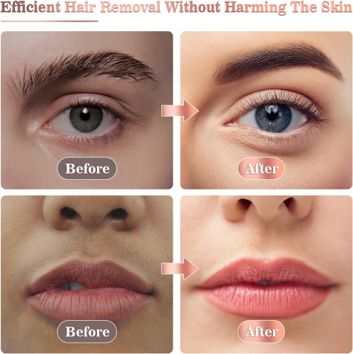 Facial Hair Remover for Women,Face Hair Trimmer,Rechargeable Women Facial Shaver,Painless Lady Shavers for Face Hair,Upper Lips,Bikini Line,Body-White