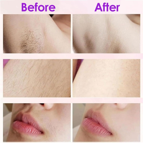 Dual Head Women Shaver,Bikini Trimmer for Women,Electric Bikini Trimmer, Electric Lady Shaver,Wet & Dry Use Hair Removal-Purple