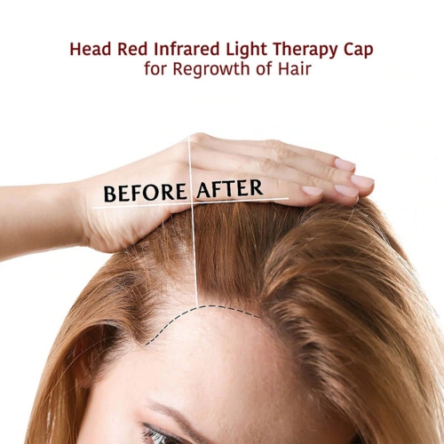 650nm Infrared LED Red Light Therapy Hat for Hair Care Laser Hair Regrowth Cap Anti-Hair Loss Cap