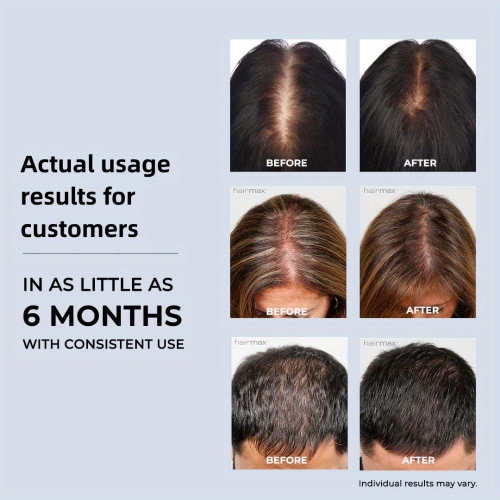 Laser Hair Growth Cap,Red Light Therapy Cap for Hair Loss,Hair Growth Hat,Anti-Loss Hair Cap for Men & Women