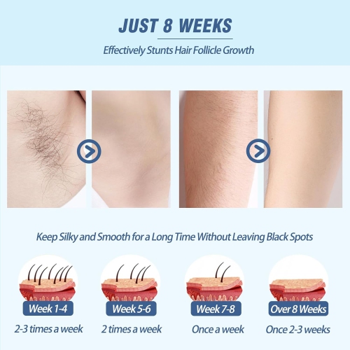 Laser Hair Removal for Women Men,IPL Hair Removal Device for Home Use with 5 Levels,Mini Painless Hair Remover Home Use for Body & Face-White