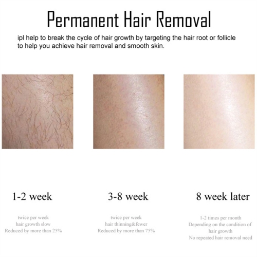 Hair Removal With Laser , Wireless Laser Hair Removal Rechargeable 4 in1 Cooling Painless Bikinis Trimmer IPL Epilator