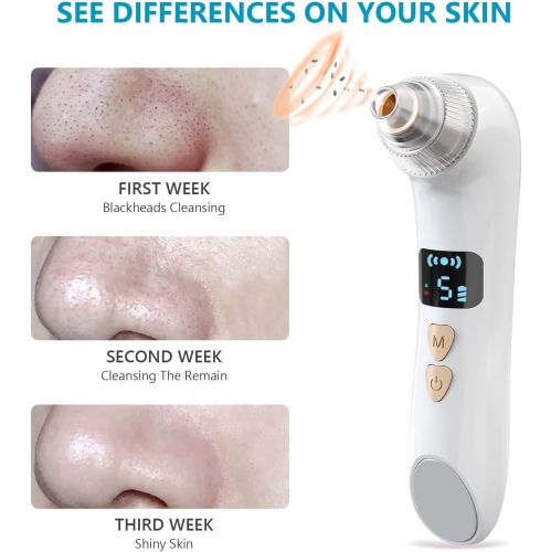 Blackhead Remover Vacuum,Blackhead Vacuum for Face with Camera,Pore Vacuum for Men & Women,6 Suction Head & 5 Mode,Blackhead Remover Tool with Hot