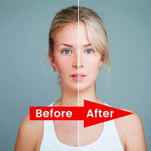 Red Light Therapy Lamp 660nm & 850nm Near Infrared Light Therapy Devices for Face and Pain Relief