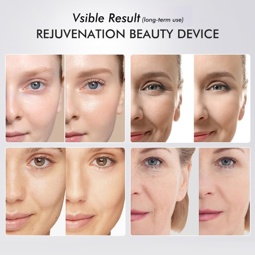 5 Color LED Light Therapy Device for Skin Care,Skin Tightening Face Beauty Device,Face Massager Tool with 5 Modes,Facial Neck Lifting,Firming & Pore