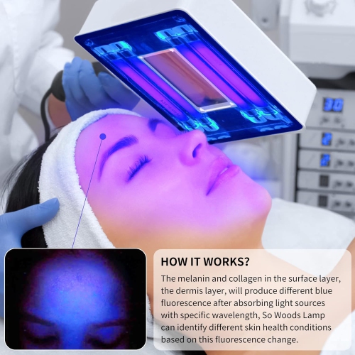 Woods Lamp Skin Analyzer,Portable Magnifying Analyzer Facial Woods Lamp with Shade Cloth,Woods Lamp for Skin Testing Home Use Salon SPA Machine