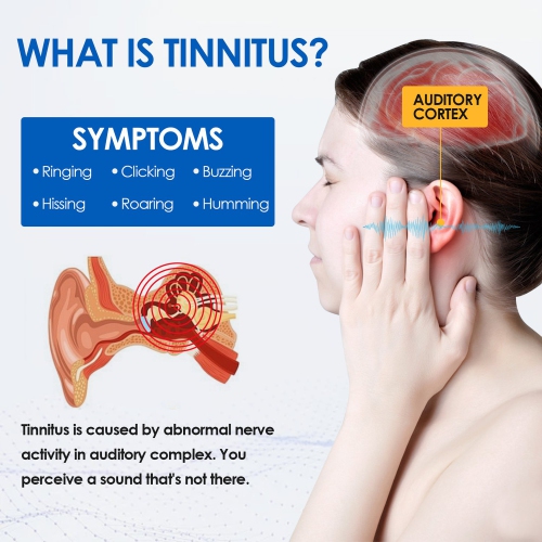Tinnitus Relief Device Tinnitus Relief for Ringing Ears,Tinnitus Relief Device ic Clip, Stop Ear Ringing