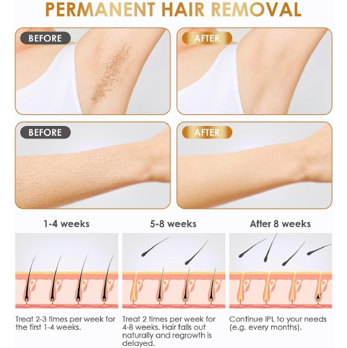 Laser Hair Removal Device for Home Use,IPL Permanent Painless Hair Remover for Women Men,Laser Hair Removal for Body Facial Face Armpits Back Legs