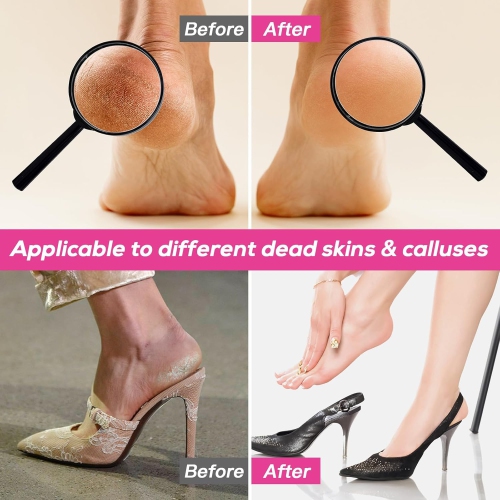 Electric Foot File,Rotatable Electric Foot Dead Skin Remover Callus Remover Tool for Home & Nail Salon with 60 pcs Replacement Sandpaper Discs,Black