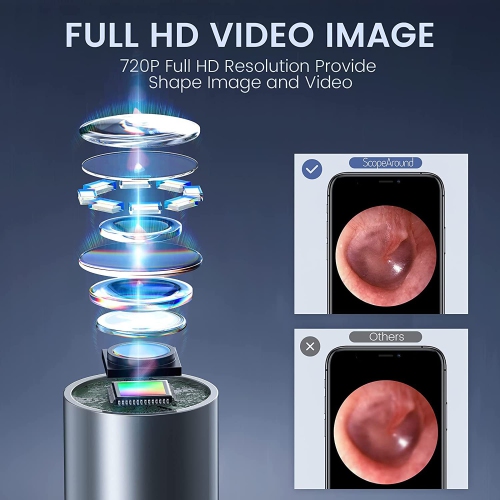 Otoscope sans fil, caméra auriculaire 3,9 mm WiFi avec 6 lampes LED pour enfants et adultes, compatible avec Android et iPhone