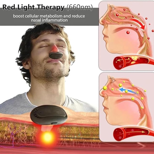 Red Light Nasal Therapy Device Nose Nasal Soothing Device External Nasal Relaxer for Rhinitis Infrared Light Rhinitis Device