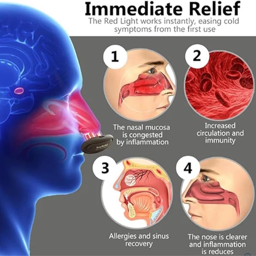 Red Light Nasal Therapy Device Nose Nasal Soothing Device External Nasal Relaxer for Rhinitis Infrared Light Rhinitis Device