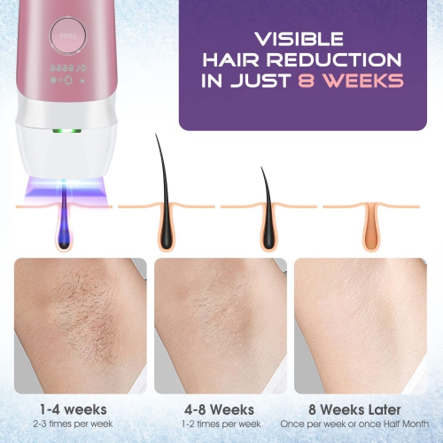IPL Laser Permanent Portable Hair Removal Device Home Handle