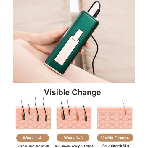 Épilation laser pour femmes et hommes, appareil d'épilation avec épilation rafraîchissante pour jambes faciales Bras tout le corps à la maison