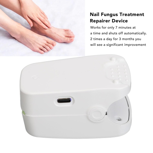 Nail Fungus Remover Device,Blue Light Therapy Nail Fungus Light,Nail Fungus Cleaning Light Therapy Lamp