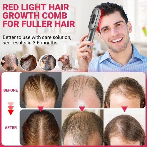 Laser Therapy Hair Growth Comb,Laser Red Light Therapy Comb for Hair Loss & Growth,Alopecia and Scalp Care for Women Men