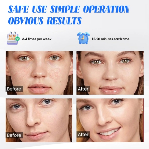 Beauty LED Mask,Red Light & Infrared Light Therapy Face Mask for Wrinkles,LED Mask for Facial Skincare,Portable Face Mask for Home Use and Travel