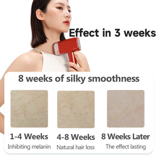 Hair Removal Device, 0.5 sec/flash, 17J High Energy IPL Hair Removal Device with Ice Cooling System, 5 Energy Levels, Hair Removal Device for Face,