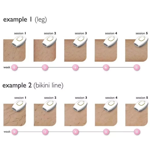 Automatic hair removal instrument handheld face and body painless intense pulse laser IPL hair removal instrument