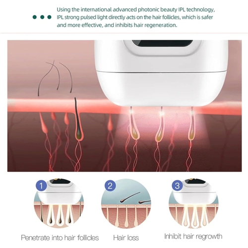 Home laser hair removal device, IPL permanent hair removal, significant effect in 8 weeks, facial and full body hair removal for men and women