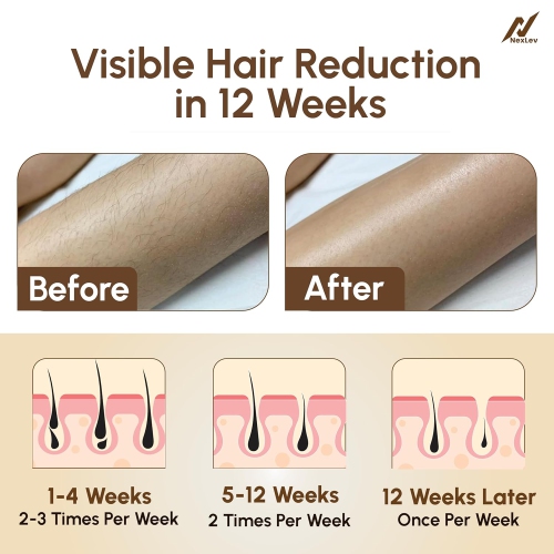 Laser Hair Removal Device Wood Grain Hair Removal Device Painless Home Portable Mini Photorejuvenation Hair Removal Device Dual Mode