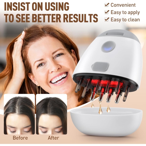 Brosse électrique pour le cuir chevelu, applicateur d'huile pour les cheveux pour le cuir chevelu, vibration pour le chevelu Croissance des cheveux