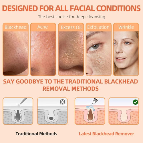 Pore Vacuum,USB Rechargeable Blackhead Remover Vacuum,3 Levels Adjustable Pore Vacuum Blackhead Remover,Face Vacuum Pore Cleanser for Women & Men