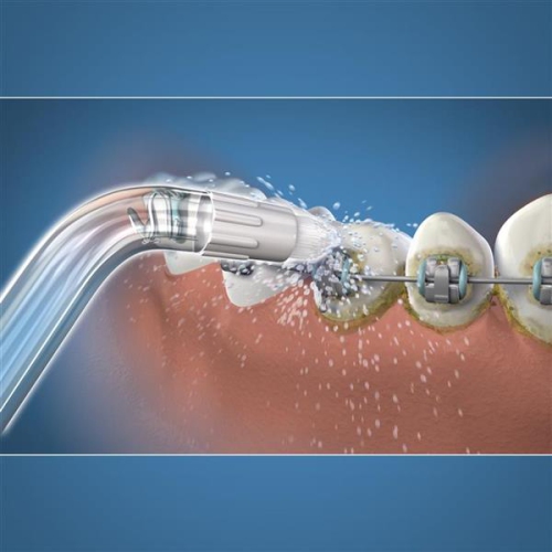 Pointes orthodontiques Waterpik™