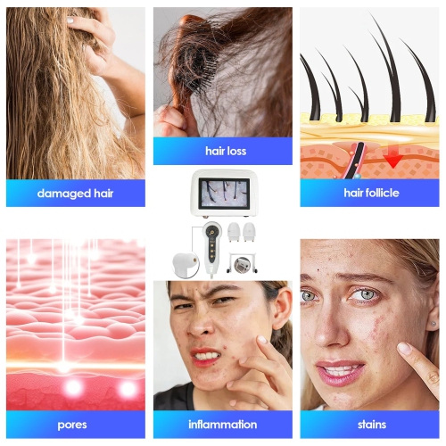 5 Inch Skin Analyzer Skin Hair Scalp Detector Dermoscopy Tester Analyser For Diagnosis Skin Care Tools, Skin Hair Analyzer, With 2 Lens Rechargeable