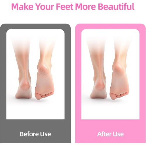 Cordless Electric Foot Callus Remover,Rechargeable Adjustable Speed Feet File,Wireless Professional Pedicure Tool for Heel Dead Skin & Calluses