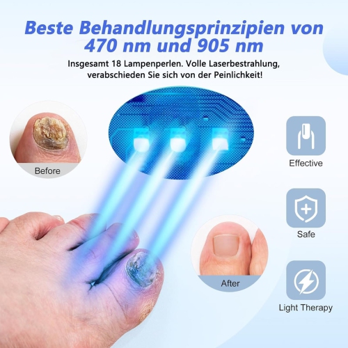 Appareil de luminothérapie, dispositif de traitement des ongles champignons, dispositif laser froid Onychomycose très efficace pour le nettoyage et