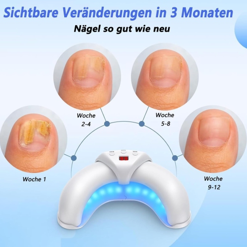 Appareil de luminothérapie, dispositif de traitement des ongles champignons, dispositif laser froid Onychomycose très efficace pour le nettoyage et