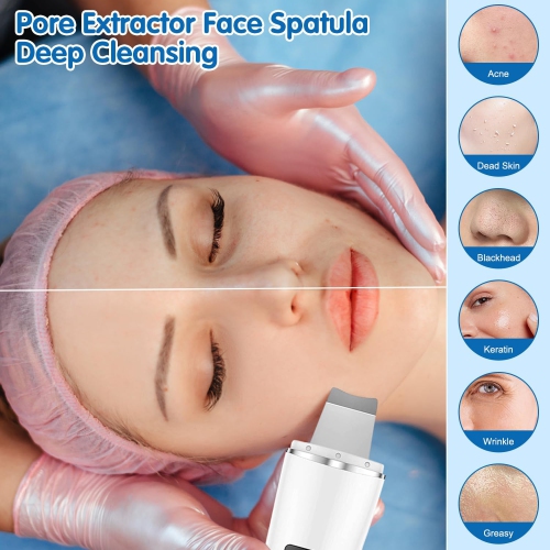 Face Scrubber Skin Spatula-2024 New Blackhead Remover Pore Cleaner,Pore Extractor Face Spatula Deep Cleaning for Facial Skin Care Women Gift(White)